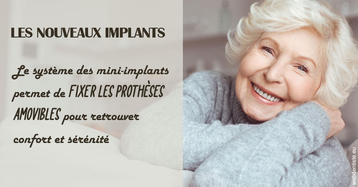 https://dr-dauby-tanya.chirurgiens-dentistes.fr/Les nouveaux implants 1