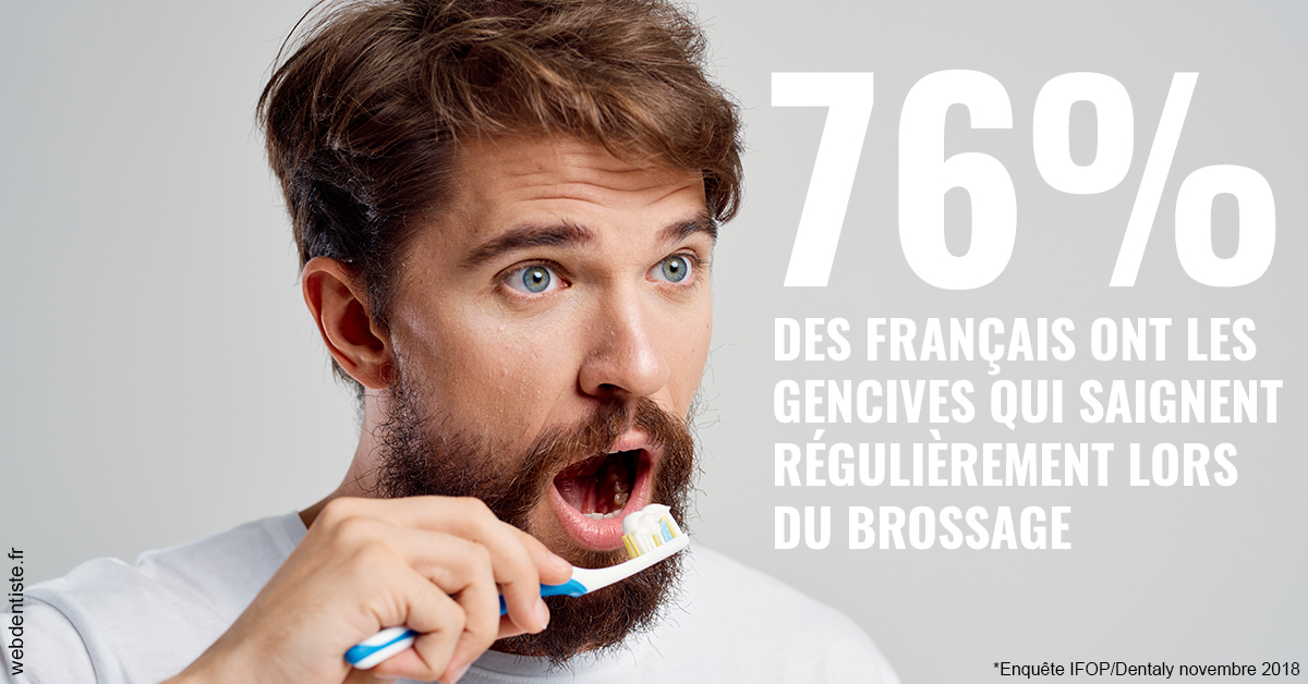 https://dr-dauby-tanya.chirurgiens-dentistes.fr/76% des Français 2