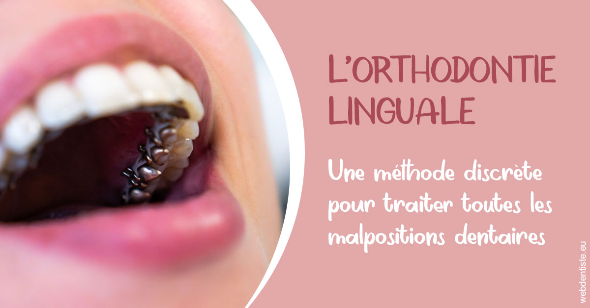 https://dr-dauby-tanya.chirurgiens-dentistes.fr/L'orthodontie linguale 2