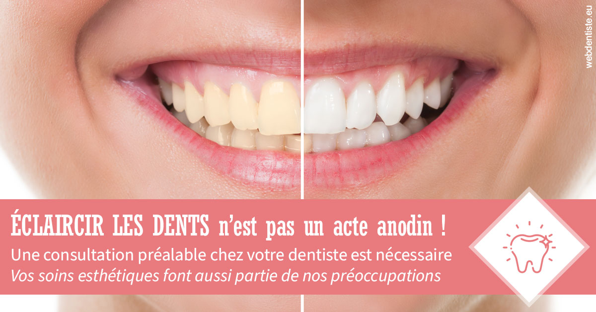 https://dr-dauby-tanya.chirurgiens-dentistes.fr/Eclaircir les dents 1