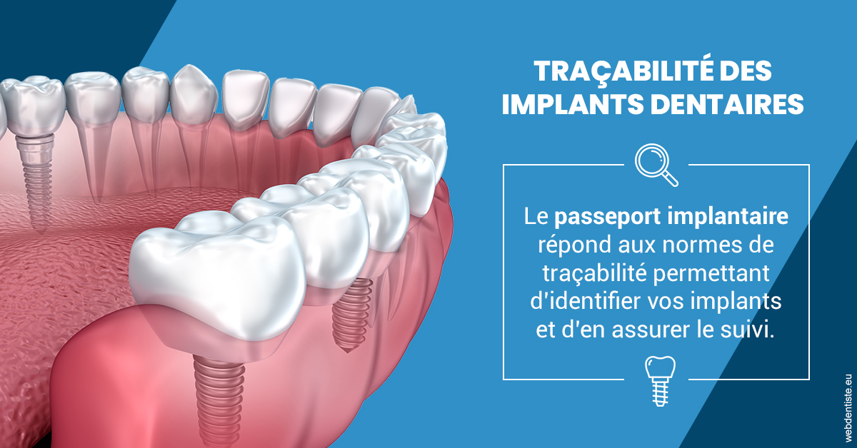 https://dr-dauby-tanya.chirurgiens-dentistes.fr/T2 2023 - Traçabilité des implants 1
