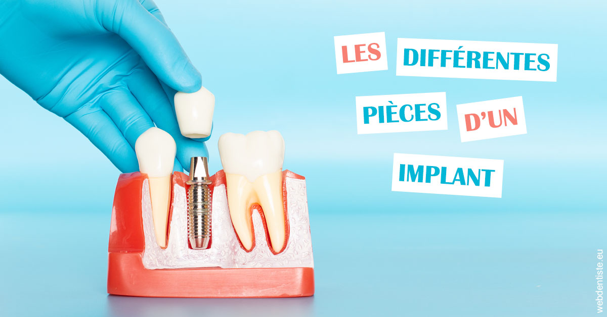 https://dr-dauby-tanya.chirurgiens-dentistes.fr/Les différentes pièces d’un implant 2