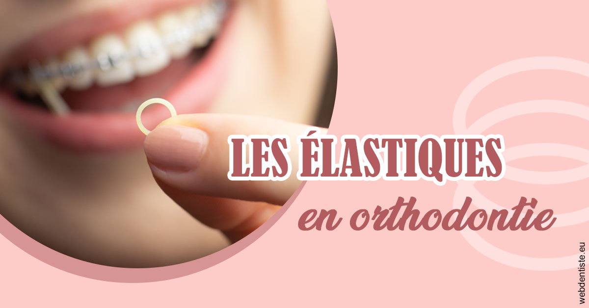 https://dr-dauby-tanya.chirurgiens-dentistes.fr/Elastiques orthodontie 1