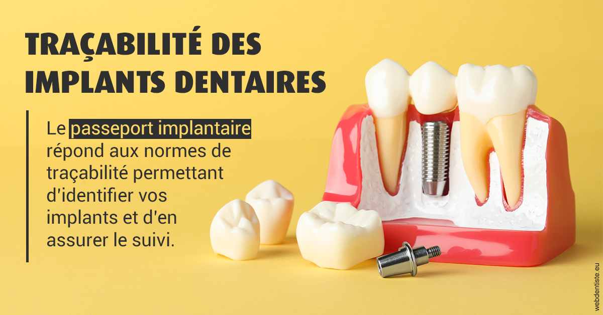 https://dr-dauby-tanya.chirurgiens-dentistes.fr/T2 2023 - Traçabilité des implants 2