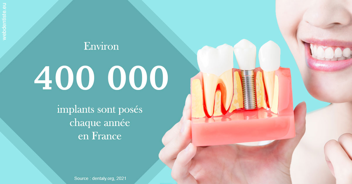 https://dr-dauby-tanya.chirurgiens-dentistes.fr/Pose d'implants en France 2
